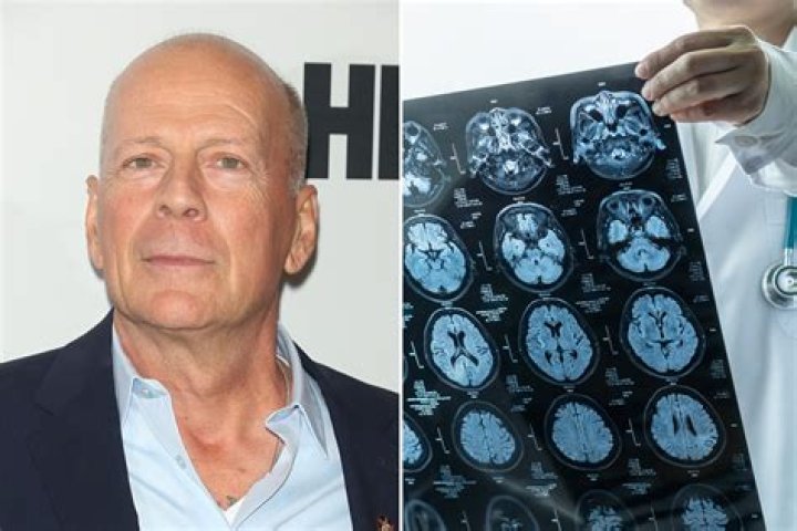 Bruce Willis Heart Attack: A Hoax or a Reality?