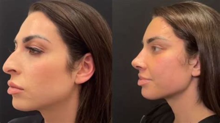 Is Leila Hormozi Transgender? Before Surgery Photos – Meet Husband Alex Hormozi