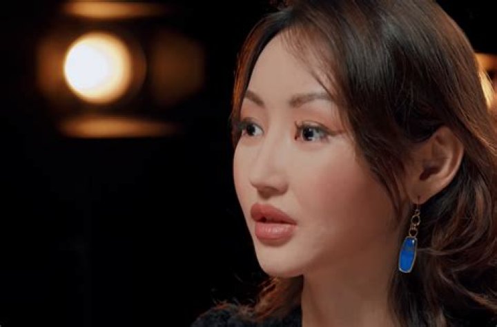 Unveiling Yeonmi Park's Surgery: Uncovering Truths And Insights